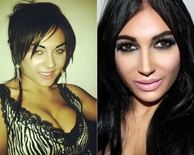 30+ People With Plastic Surgery Transformations