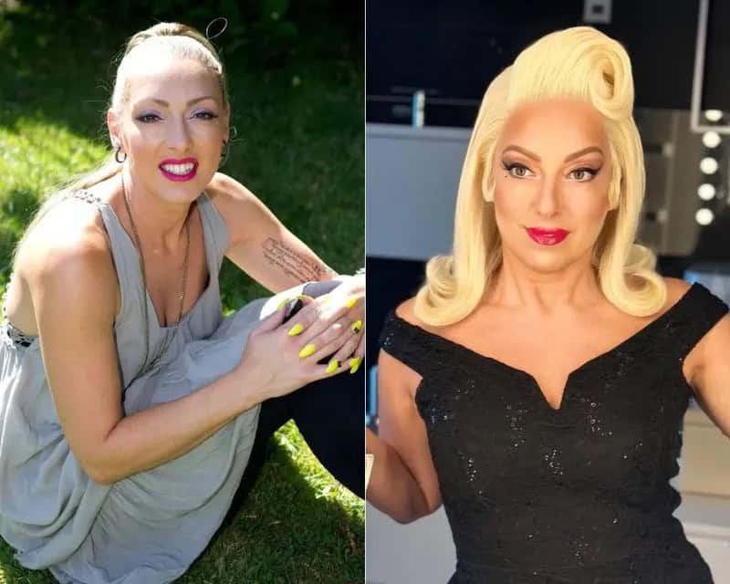 30+ People With Plastic Surgery Transformations