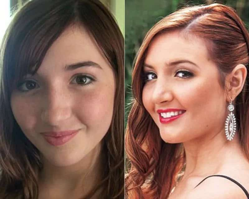 30+ People With Plastic Surgery Transformations