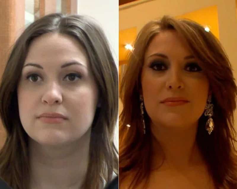 30+ People With Plastic Surgery Transformations